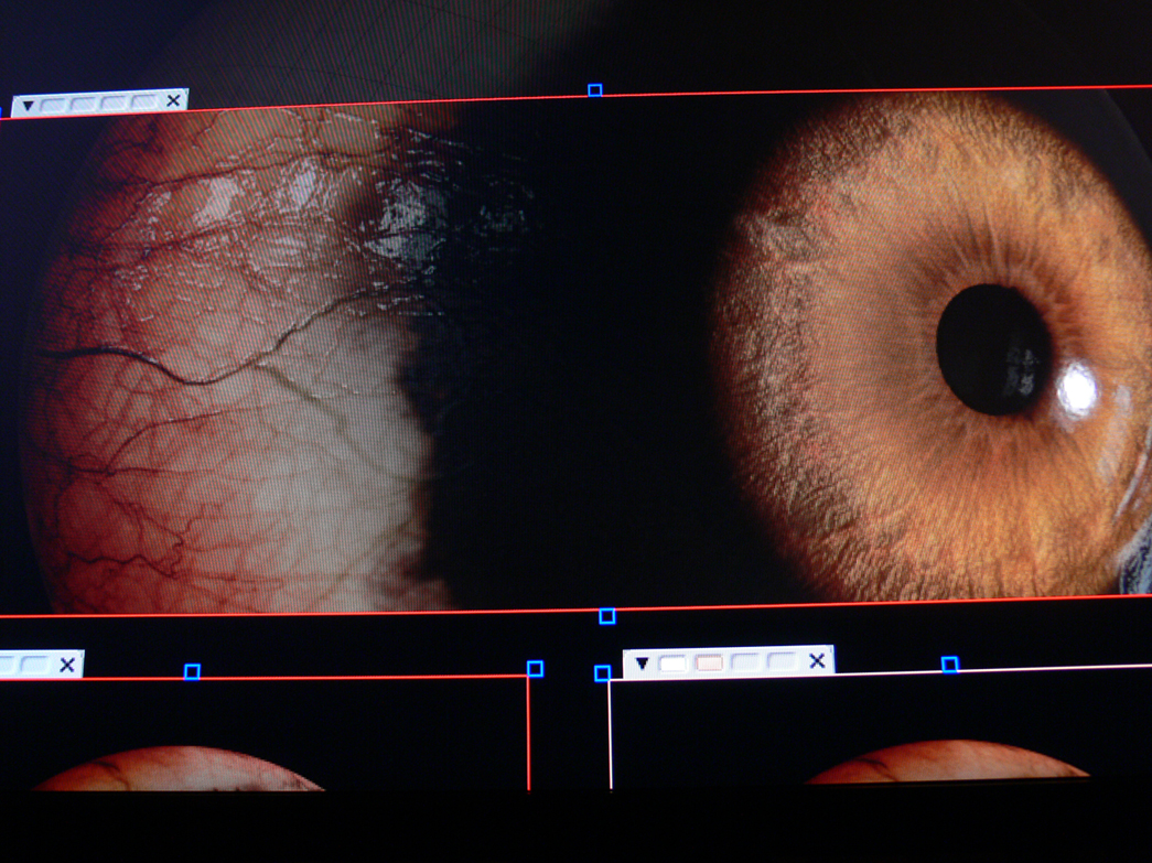 scr_eyeG